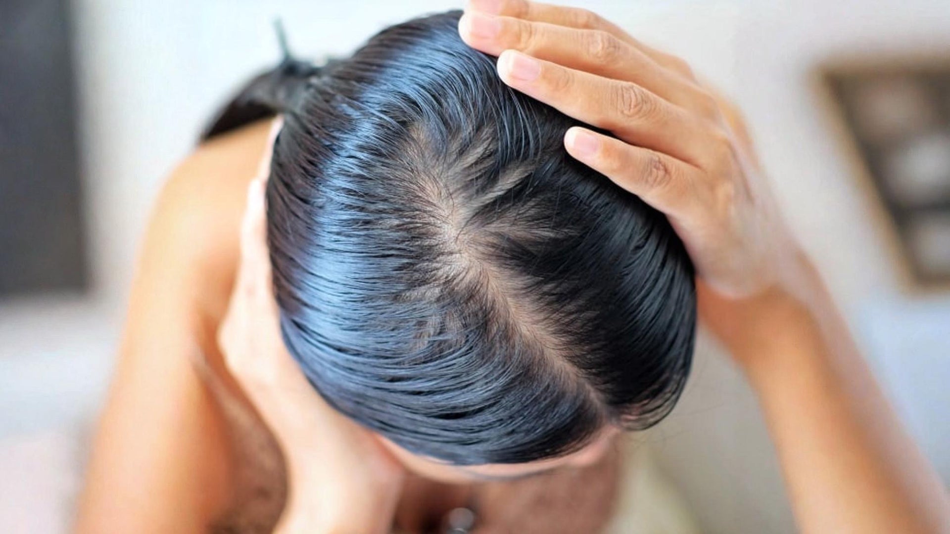 Fett Hår & Scalp Balance